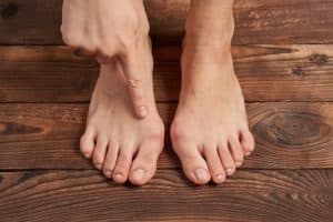 הלוקס ולגוס Hallux valgus